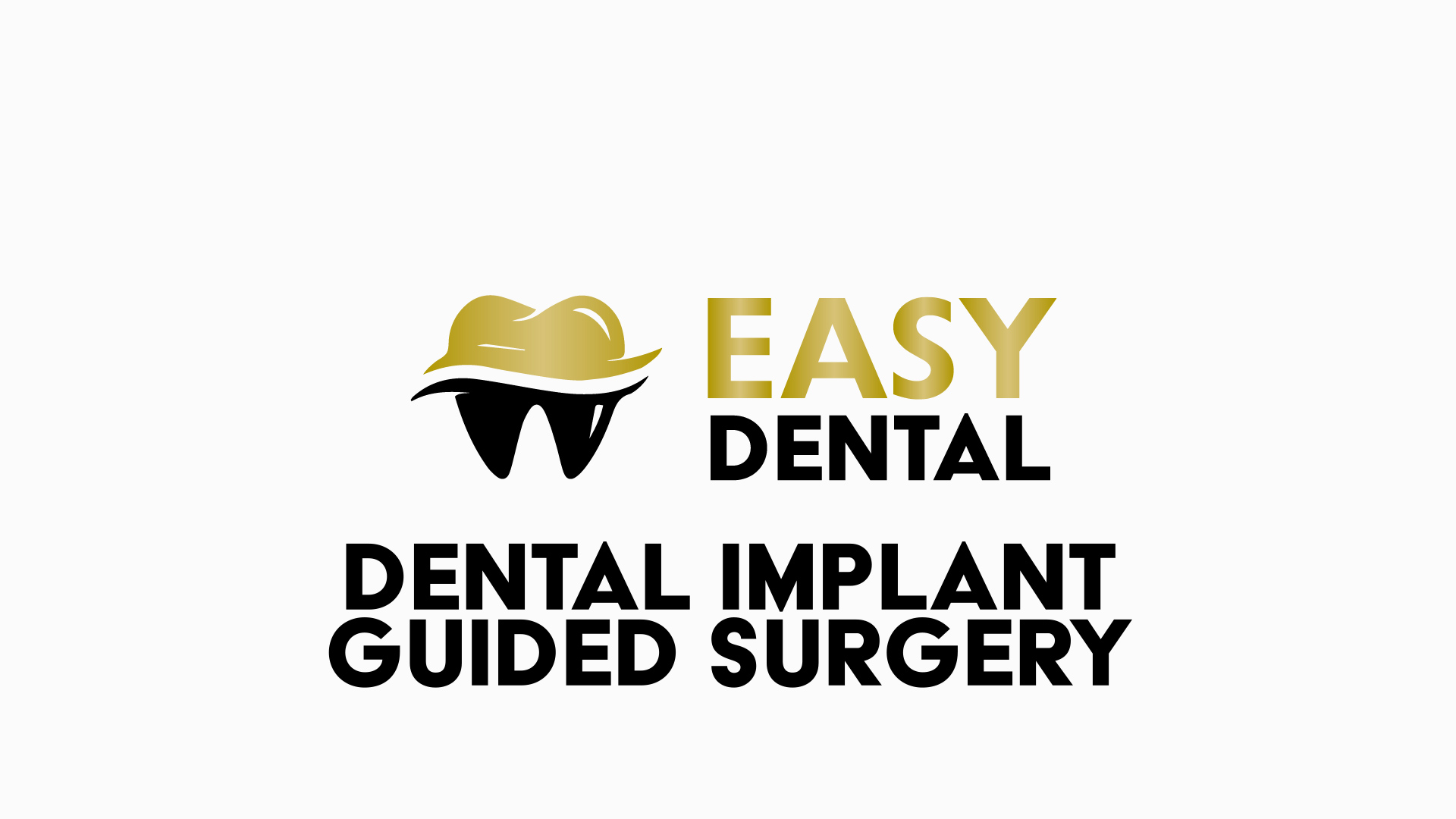 Guided Implant Video